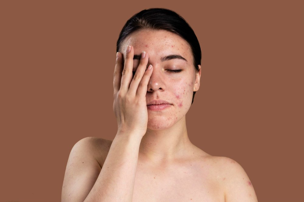 Dark Spots on Skin: Causes, Symptoms & Remedies